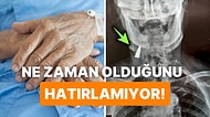 Başka Bir Rahatsızlığı İçin Röntgen Çektirirken Boynunda Bir Kurşun Olduğunu Öğrenen Adam Herkesi Şaşırttı