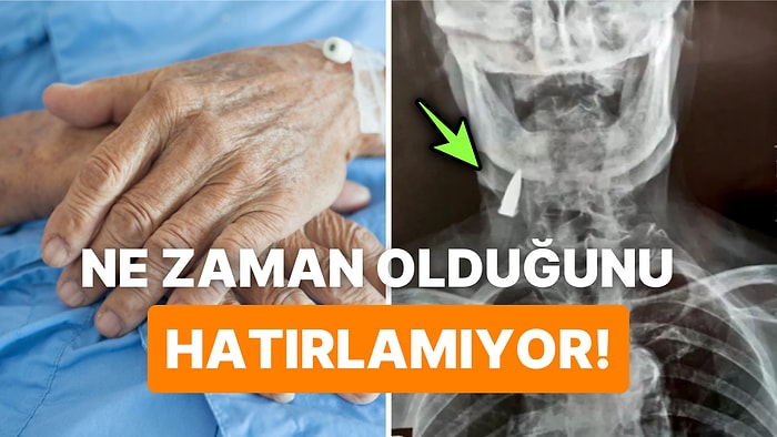 Başka Bir Rahatsızlığı İçin Röntgen Çektirirken Boynunda Bir Kurşun Olduğunu Öğrenen Adam Herkesi Şaşırttı