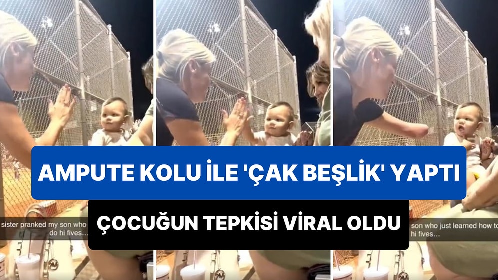 Ampute Kolu ile 'Çak Beşlik' Şakası Yaptığı Çocuğun Tepkisini Kaydeden Kadın