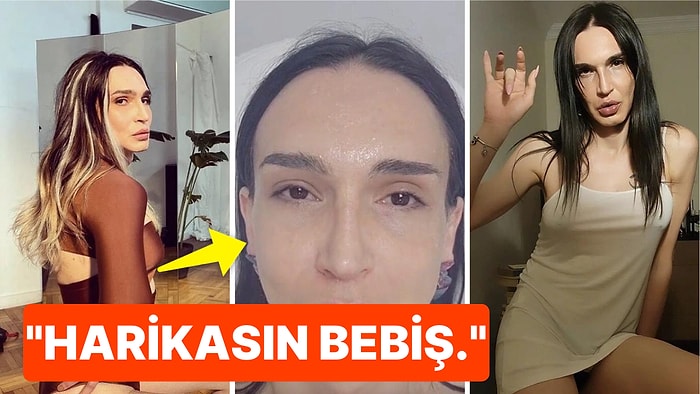 Cinsiyet Geçiş Operasyonundan Sonra Bambaşka Biri Olan Meli Bendeli Estetik Yaptırdığı Görüntüleri Paylaştı