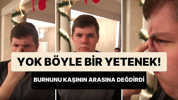 Burnunun Ucunu İki Kaşının Arasına Değdirebilen Gencin İlginç Yeteneği