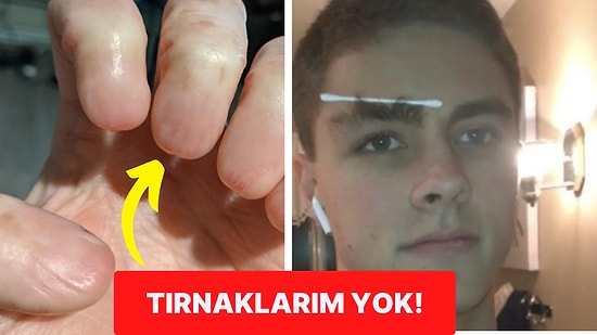 Dünyaya Adeta İnsanları Şaşırtmaya Gelmiş Fiziksel Özellikleri ile Ağızları Açık Bırakan 18 Kişi