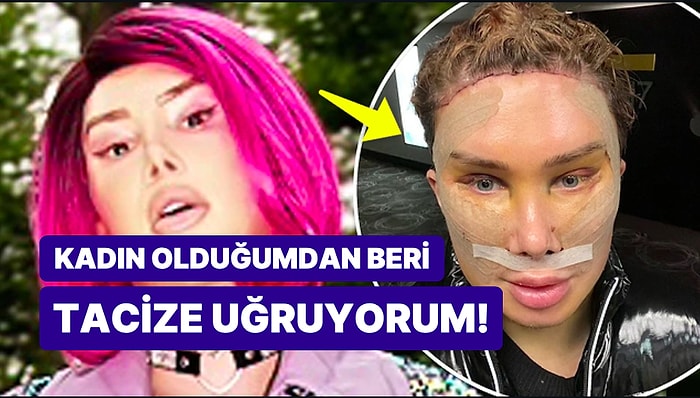 32 Ameliyat Geçiren TikTok Fenomeni Kararından Vazgeçti: 'Yeniden Erkek Olmak İstiyorum'