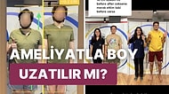 Türkiye'de Ameliyatla Boyunu 10 Cm Birden Uzatan TikTok Fenomeni Özkan Sağın'ın Son Görüntüsü Şaşırttı