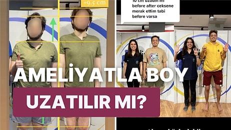 Türkiye'de Ameliyatla Boyunu 10 Cm Birden Uzatan TikTok Fenomeni Özkan Sağın'ın Son Görüntüsü Şaşırttı