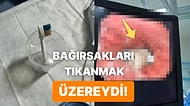 Nasıl Yutabildi? 9 Yaşındaki Çocuğun Midesinden Çıkarılan Cisim Gören Herkesi Şoke Etti!