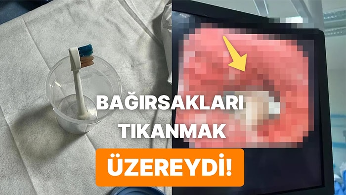 Nasıl Yutabildi? 9 Yaşındaki Çocuğun Midesinden Çıkarılan Cisim Gören Herkesi Şoke Etti!