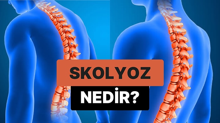 Omurganın Yana Doğru Eğriliği Hastalığı: Skolyoz Nedir?