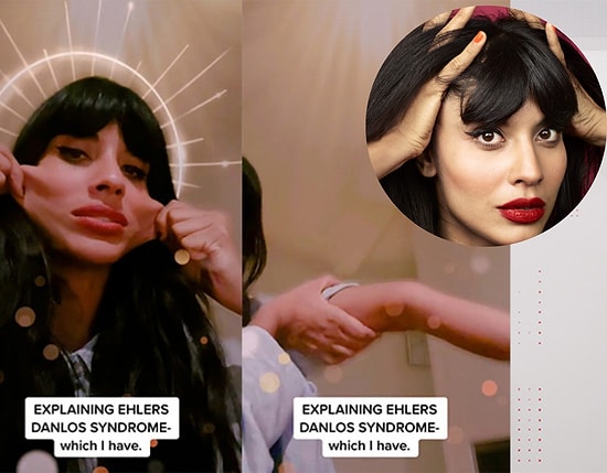 Джамила Джамил из «Женщина Халк» рассказала о своём редком заболевании