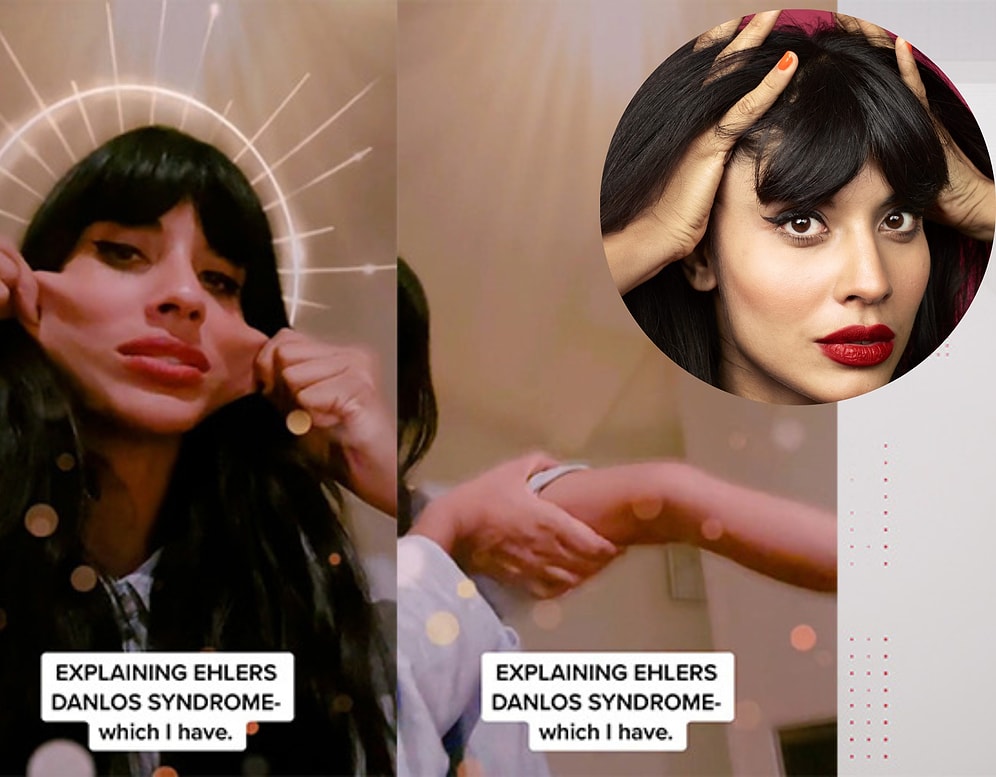 Джамила Джамил из «Женщина Халк» рассказала о своём редком заболевании