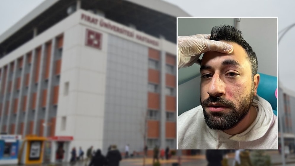 Şizofreni Hastası, Doktora Yumruk Attı: "Bana Bir Şey Olmaz, Seni Burada Öldüreceğim"