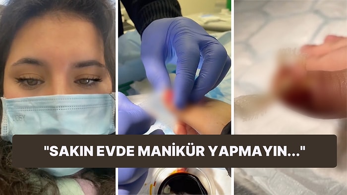 Evde Manikür Yapayım Derken Hastanelik Olup Tırnağı Çekilen Bahtsız Kadının Hikayesi