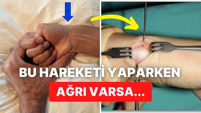 Başparmağınızı Hareket Ettirirken Ağrı Varsa Daha Önce Fark Etmediğiniz Bir Hastalığınız Olabilir