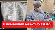 Vücuduna Patlamamış El Bombası Saplanan Ukraynalı Asker Şans Eseri Hayatta Kaldı!