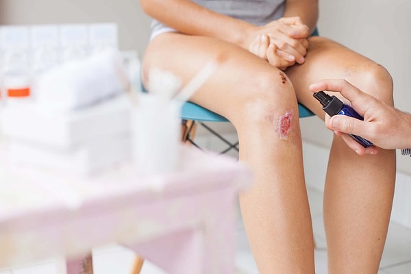 7. Если у вас открытая рана, можно использовать алкоголь в качестве антисептика. Да или нет?