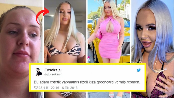 Seksi Görünmek İçin Estetik Ameliyatlara Servet Harcayan Kadının Açıklamaları: "Harcadığım Her Kuruşa Değdi!"