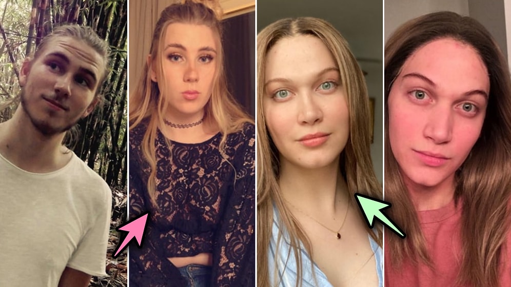 Cinsiyet Geçiş Ameliyatları Sonrası Hayal Ettikleri Bedene Kavuşan İnsanların Muhteşem Değişimi