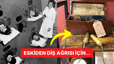 Öğrendiğinizde Modern Tıbbın Geliştiğine Sevineceğiniz Birbirinden Tuhaf Tedavi Yöntemleri