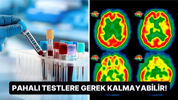 Pahalı Taramalara İhtiyaç Duymadan Alzheimer Hastalığını Tespit Edebilecek Yeni Bir Kan Testi Bulundu!