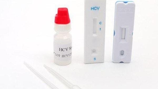 Anti HCV Negatif Ne Anlama Gelir?