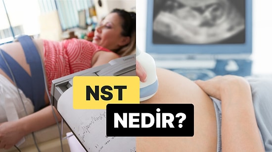 Fetüsün İyilik Halinin Değerlendirilmesini Sağlayan Bir Test: NST Nedir?