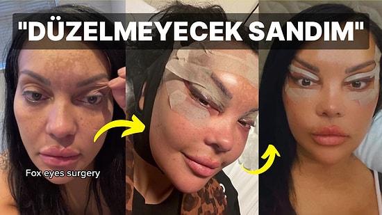 Türkiye'ye Tilki Gözü Estetiği İçin Gelen Kadın Bir Günlük Kör Kaldı: "Sonuçlarına Değer!"