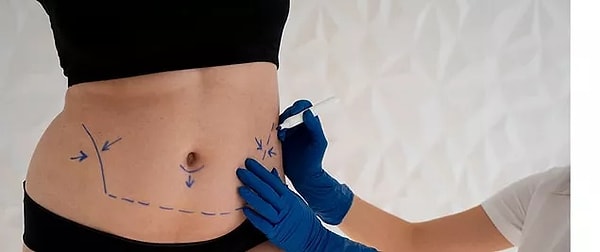 4. Tummy Tuck Surgery