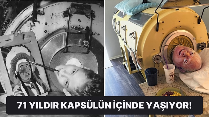 6 Yaşından Beri Demir Bir Kapsülün İçinde Yaşamak Zorunda Kalan Adamın İlginç Hayat Hikayesi