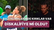 Survivor'da İnanılmaz Kaza! Yarışma Sırasında Düşen Çağla'nın Durumu Endişe Uyandırdı
