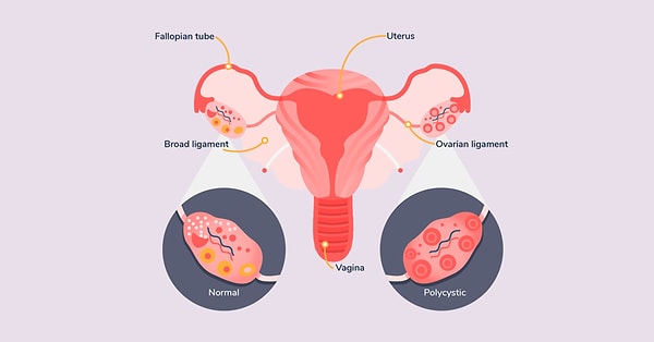 Peki hastalığın duygusal nedenleri nelerdir? Sindirim sistemimizin yanı sıra bir de duygusal metabolizmamız olduğunu biliyor muydunuz?