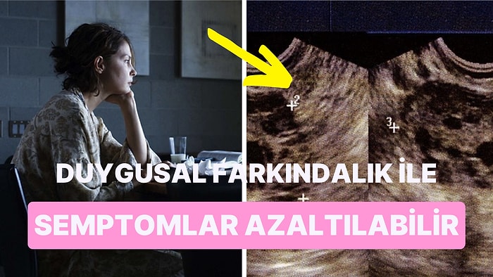 Polikistik Over Sendromuna Neden Olan Duygusal Durumunuzla Yüzleşmeye Hazır mısınız?