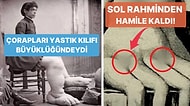 Farklılıkları Yüzünden İnsanların Önünde Sergilenen 'Sirk Ucubelerinin' Dramatik Hayat Hikayeleri