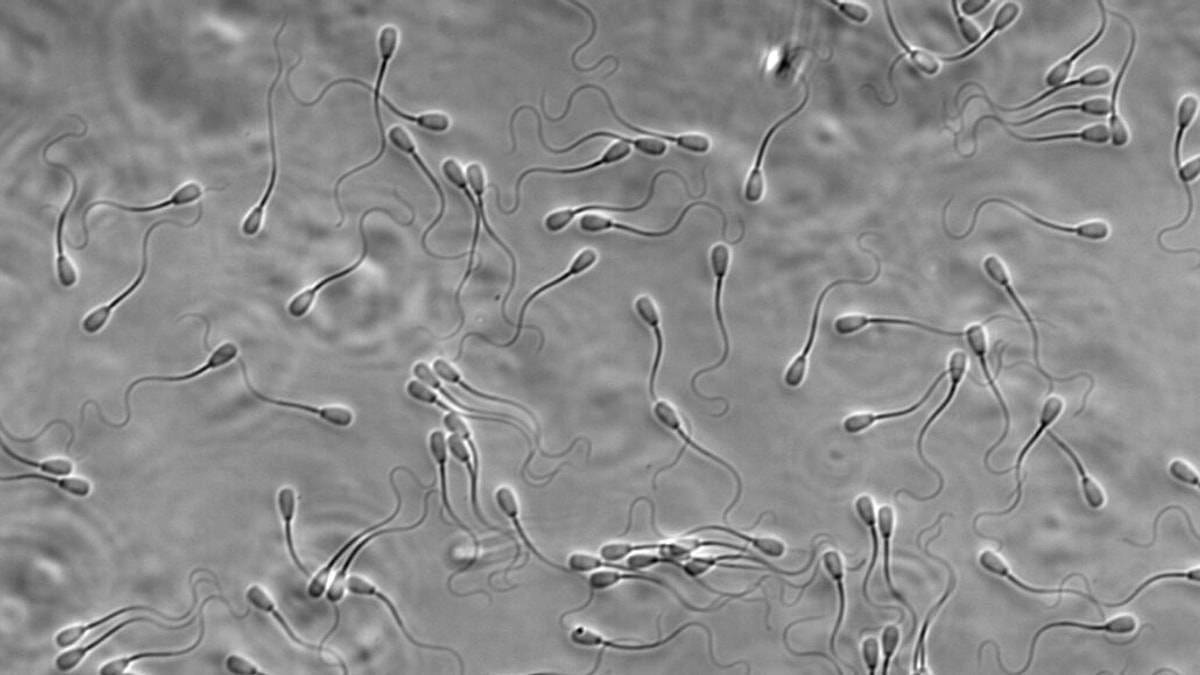 Yapılan Araştırmalar Sonucunda Farklı Alanlarda Çalışan Erkeklerin Sperm Sayısının Değiştiği