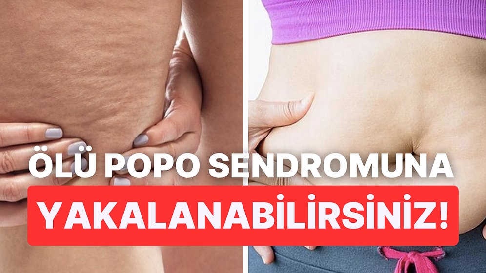 Selülit, Bel Çevresinde Yağlanma... Günde Dört Saatten Çok Oturmanın Vücudunuza Neler Yaptığını Görmelisiniz!