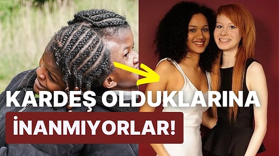 Mucizelere İnanmanızı Sağlayacak Daha Önce Görmediğiniz Dünyanın En Sıra Dışı İkizleri