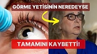 Kullandığı Yapay Gözyaşı Nedeniyle Bir Gözünü Tamamen Kaybeden Kadının Akıllara Durgunluk Veren Hikayesi
