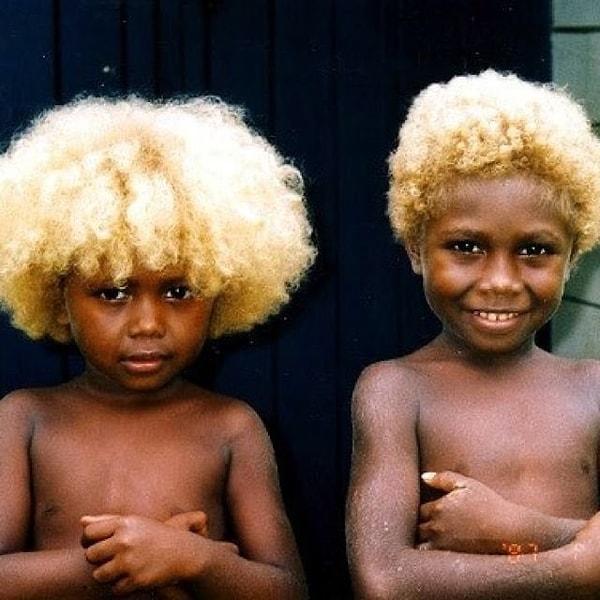 8. Koyu tenli ve sarı saçlı olan Solomon Adalılarının genlerinde, Avrupa kökenli olmadığı bulundu.