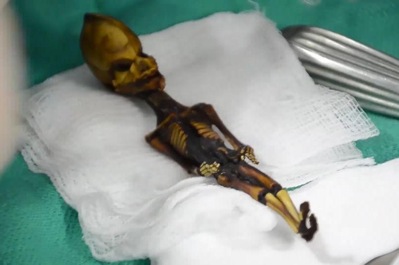Раскрыта грустная правда о загадочной 15-сантиметровой мумии, которую считали инопланетянином