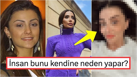 Geçirdiği Estetik Operasyonlarla Yıllar İçinde Bambaşka Birine Dönüşen Özge Ulusoy'ın Son Hali