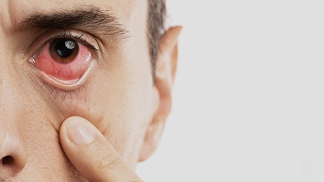 Rezene çayı, gözleri uğradığı hasarlardan korumaya yardımcı olabilecek bir antioksidan olan C vitamini içerir. Ayrıca, görme kaybına yol açabilen yaygın bir göz rahatsızlığı olan yaşa bağlı makula dejenerasyonu riskini azaltmaya yardımcı olur.
