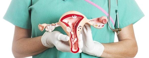 Kadınların en sık rastladıkları kadın hastalıklarından biri olan miyomları kısaca rahimde görülen normal olmayan düz kas çoğalmaları olarak tanımlamak mümkün.