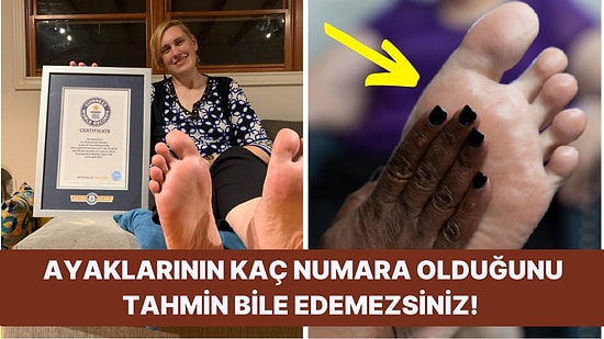 Dünyanın En Büyük Ayaklı Kadını Rekoruna Sahip Tanya Herbert, Günlük Hayatta Yaşadığı Sorunları Anlattı