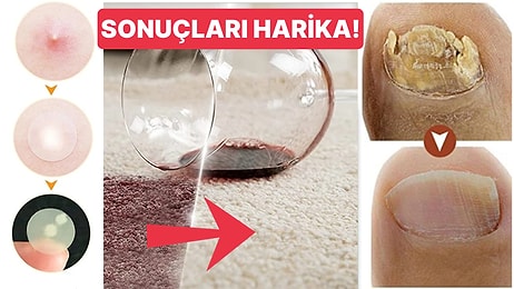 Öncesi ve Sonrası Fotoğrafları İnanılmaz Olan 19 Ürün