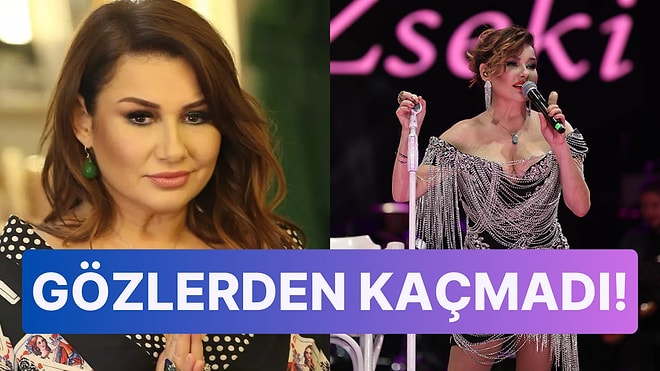 Yaptırdığı Estetikle Bambaşka Biri Olmuştu: Deniz Seki Barbie Akımına Uydu!