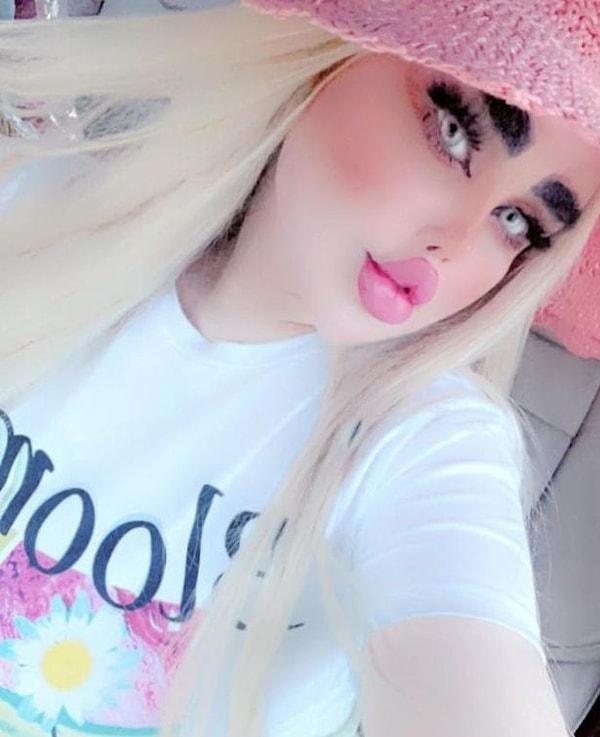 Estetik facialarının çoğu, Barbie bebeğe benzeme takıntısından ortaya çıkıyor: Bunlardan biri de "Iraklı Barbie" olarak tanınan Dalia Naeem.
