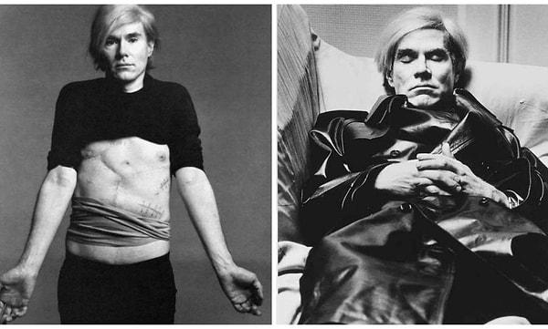 İki ay boyunca hastanede yatan Warhol, ömrünün sonuna kadar cerrahi korse takmak zorunda kalacaktı ancak hayat devam ediyordu.