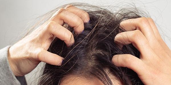 Düzenli olarak şampuan kullanımını atlamak ve sadece saç kremi kullanmak kafa derisinde ürün birikmesine neden olur.