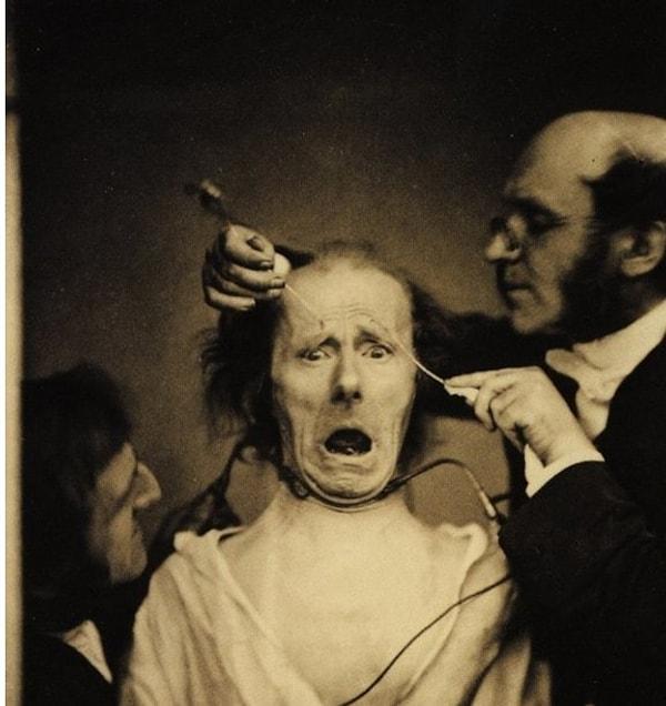 7. 1862'de Fransız nörolog Duchenne de Boulogne yüz kaslarını incelemek için bir adamın yüzüne elektrik veriyor.