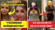 Kilo Vererek Vücutlarını ve Hayatlarını Tamamiyle Değiştiren Kişilerden Hepimizi Dumur Eden 15 Fotoğraf