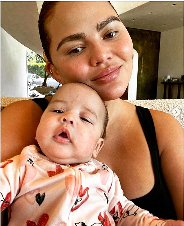 Крисси Тейген ранее открыто рассказала о своем опыте кесарева сечения, подчеркнув, что она ценит и уважает оба способа родов, которые пережила. Она поделилась своими мыслями, выражая признание к тому, что каждый опыт родов уникален и имеет свои особенности. Крисси настаивает на том, что важно поддерживать и признавать разные пути, которые матери выбирают для приветствия своих детей в этот мир.